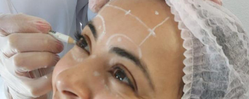 Aplicação de botox